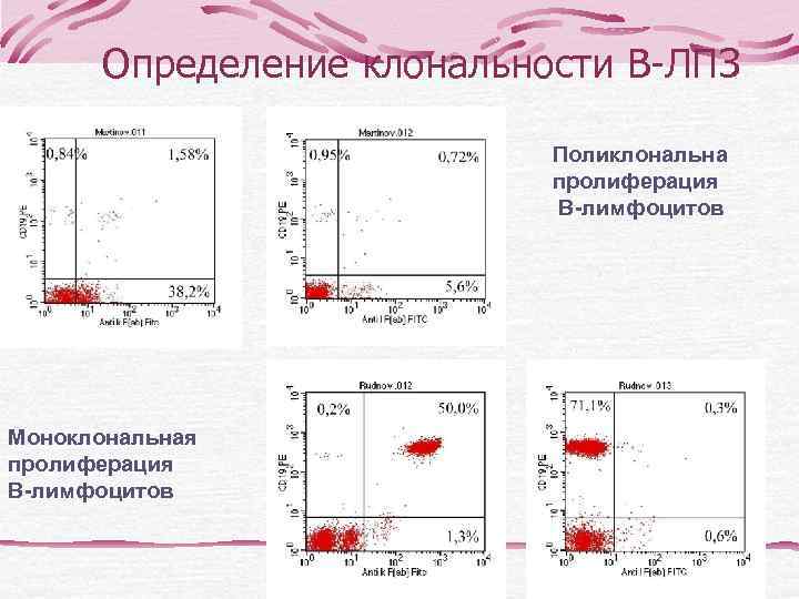    Фолликулярная лимфома  Группа лимфоидных опухолей, происходящих из светлых  центров