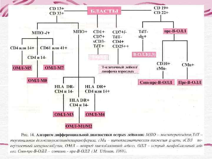  Иммунофенотип опухолевых клеток: CD 19+CD 5+CD 20+(высокая экспрессия)CD 23 -  CD 5/CD