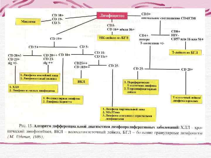 Лейкемическая фаза лимфомы из клеток мантийной зоны(бластоидный вариант) Морфология клеток  не отличается от
