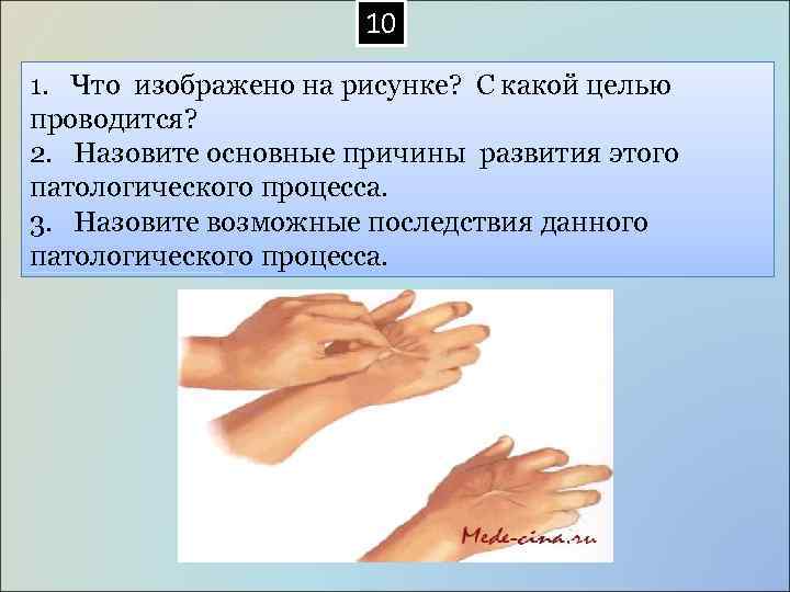  10 1. Что изображено на рисунке? С какой целью проводится? 2. Назовите основные