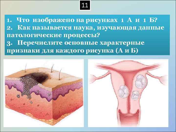  11 1. Что изображено на рисунках 1 А и 1 Б? 2. Как