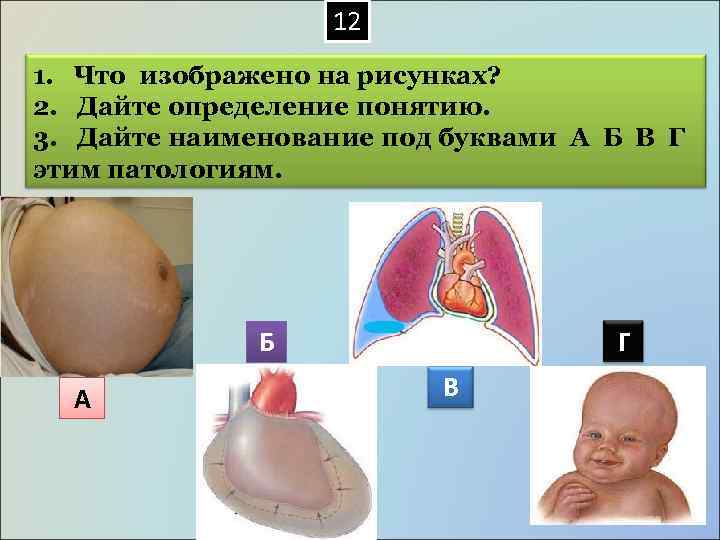  12 1. Что изображено на рисунках? 2. Дайте определение понятию. 3. Дайте наименование