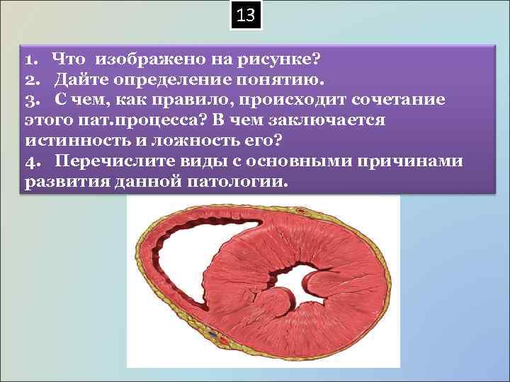  13 1. Что изображено на рисунке? 2. Дайте определение понятию. 3. С чем,