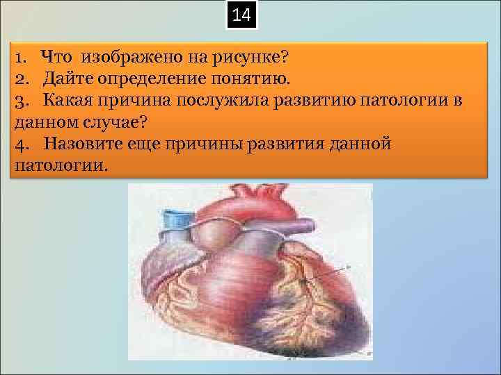  14 1. Что изображено на рисунке? 2. Дайте определение понятию. 3. Какая причина