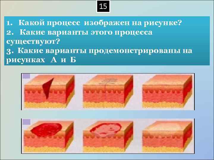  15 1. Какой процесс изображен на рисунке? 2. Какие варианты этого процесса существуют?