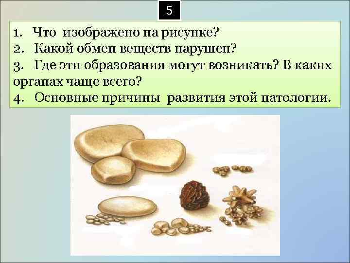  5 1. Что изображено на рисунке? 2. Какой обмен веществ нарушен? 3. Где