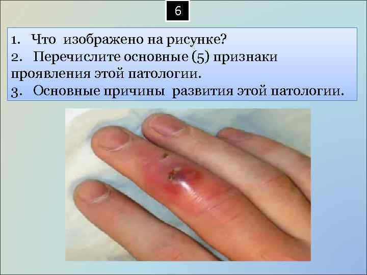  6 1. Что изображено на рисунке? 2. Перечислите основные (5) признаки проявления этой