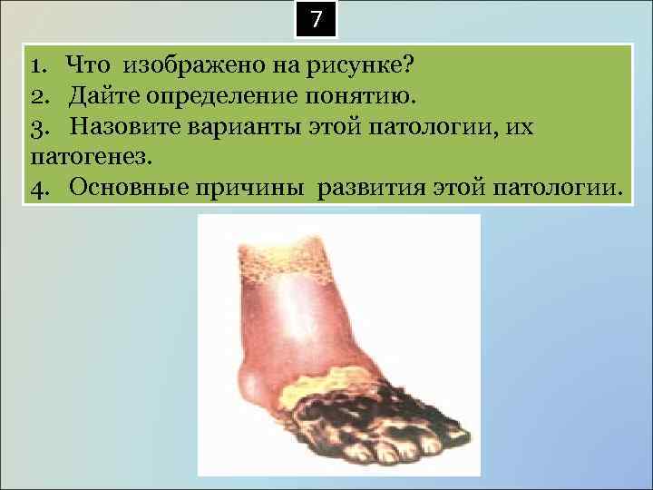  7 1. Что изображено на рисунке? 2. Дайте определение понятию. 3. Назовите варианты