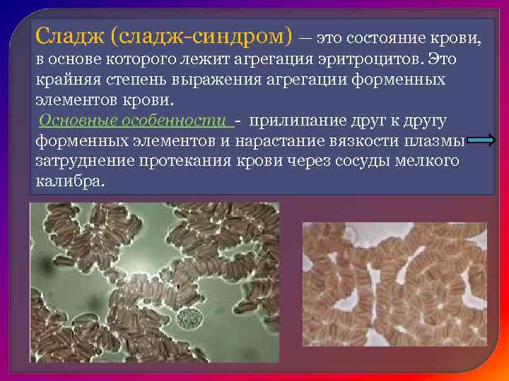 Сладж это. Сладж феномен патанатомия. Свадж феномен ПАТ анатомия. Сладж эритроцитов гистология. Стаз сладж синдром.