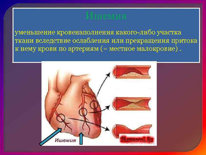 Нарушения кровенаполнения блок схема