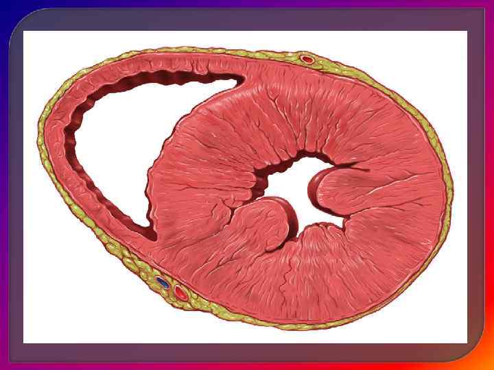 2. Тахикардия 