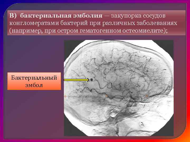    По времени возникновения:  • Первичное – при повреждении  •