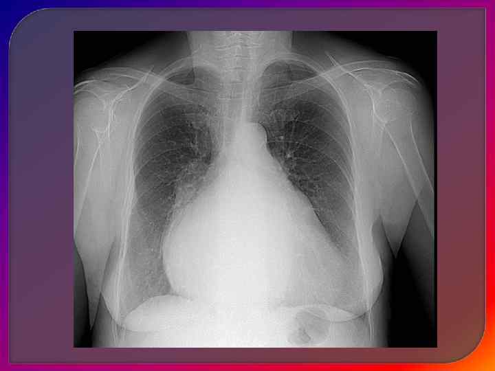 3. Выход крови из депо 