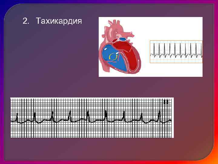  Клинические проявления СН  1.  Одышка 2.  Цианоз 3.  Тахикардия