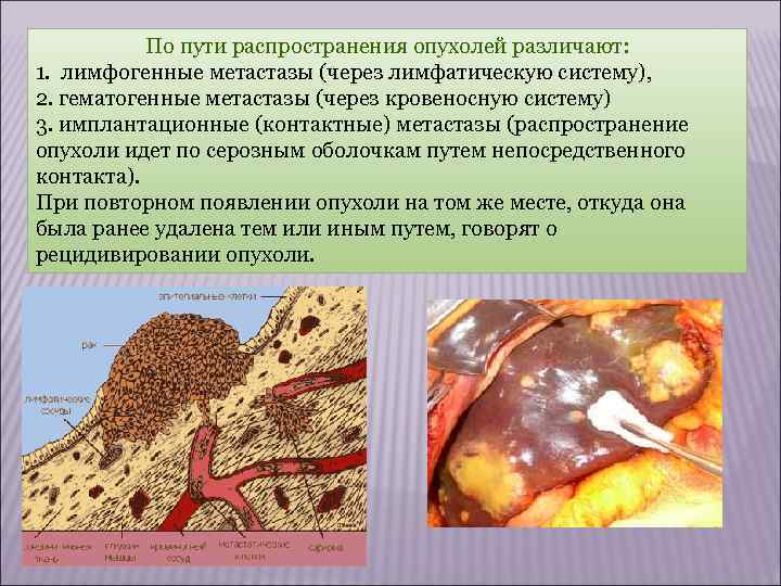  Доброкачественные и злокачественные опухоли Характеристика: 