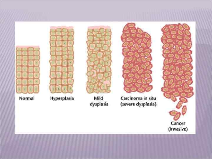 III. Мезенхимальные опухоли. К ним относятся  доброкачественные опухоли, такие как фиброма (из 