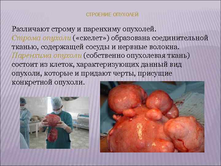       тканевой   клеточный Тканевой атипизм характеризуется «неправильностью»