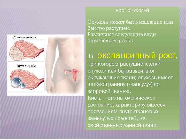 По отношению к просвету полого органа различают А - экзофитный рост, при котором опухоль