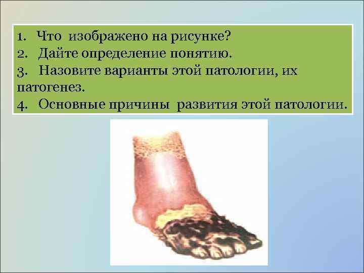 1. Что изображено на рисунке? 2. Дайте определение понятию. 3. Назовите варианты этой патологии,