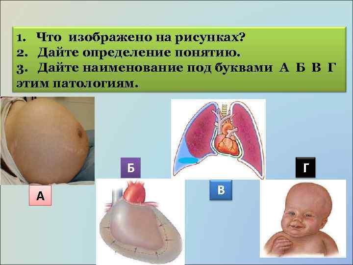 1. Что изображено на рисунках? 2. Дайте определение понятию. 3. Дайте наименование под буквами