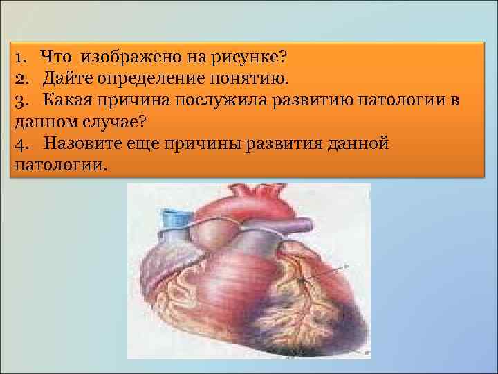 1. Что изображено на рисунке? 2. Дайте определение понятию. 3. Какая причина послужила развитию