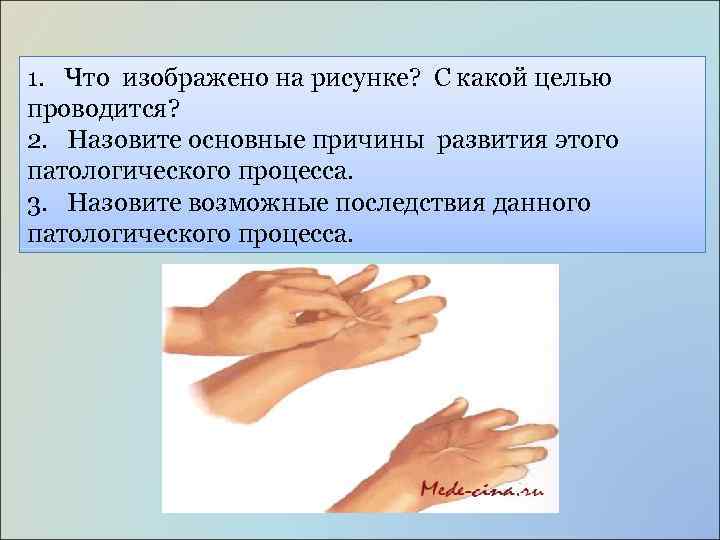 1. Что изображено на рисунке? С какой целью проводится? 2. Назовите основные причины развития