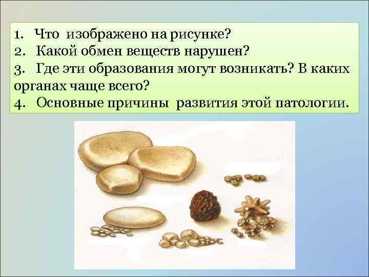 1. Что изображено на рисунке? 2. Какой обмен веществ нарушен? 3. Где эти образования