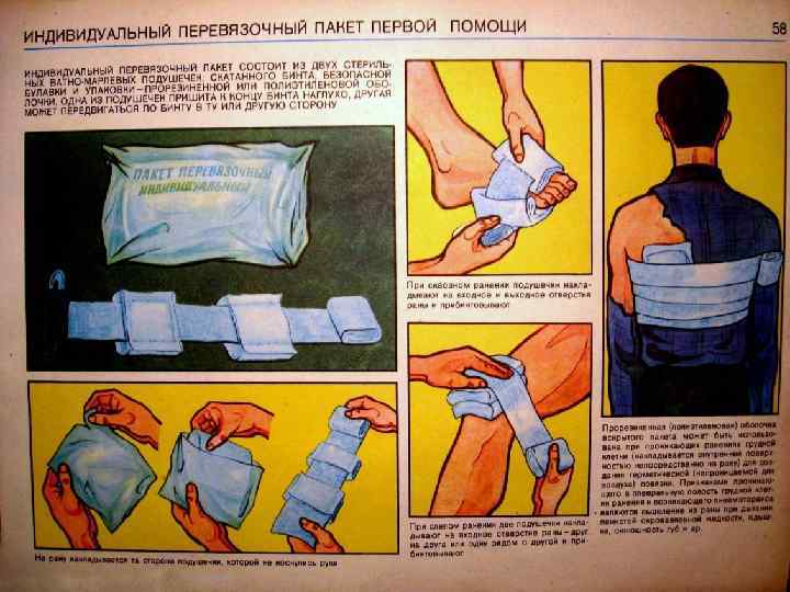    ППИ АВ-3 (атравматические, сорбционные,  влагонепроницаемые) 