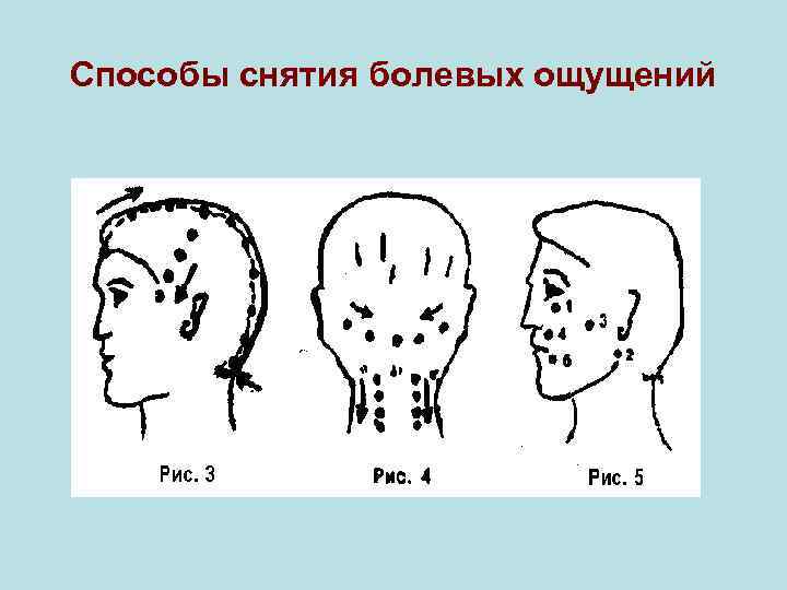 Способы снятия болевых ощущений 