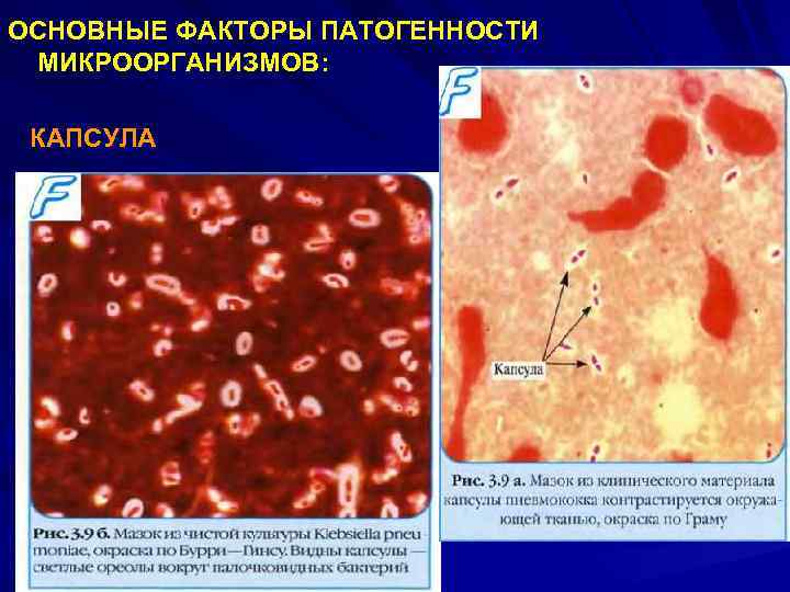 ОСНОВНЫЕ ФАКТОРЫ ПАТОГЕННОСТИ МИКРООРГАНИЗМОВ: КАПСУЛА 