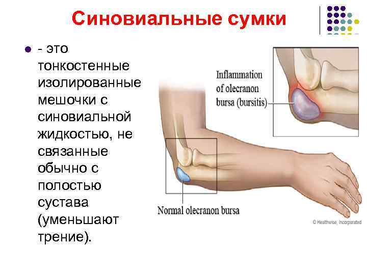  Синовиальные сумки l - это тонкостенные изолированные мешочки с синовиальной жидкостью, не связанные