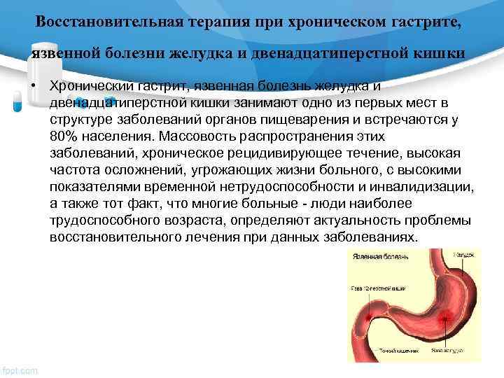 Восстановительная терапия при хроническом гастрите,  язвенной болезни желудка и двенадцатиперстной кишки  •