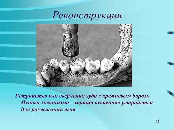   Реконструкция Устройство для сверления зуба с кремневым бором.  Основа механизма -