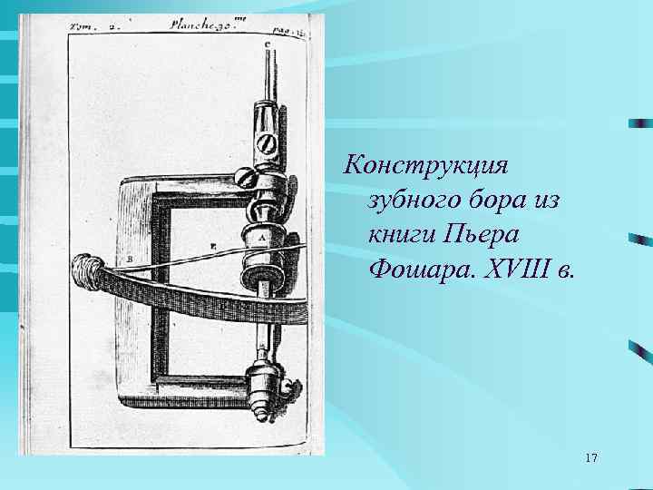 Конструкция зубного бора из книги Пьера Фошара. XVIII в.     17