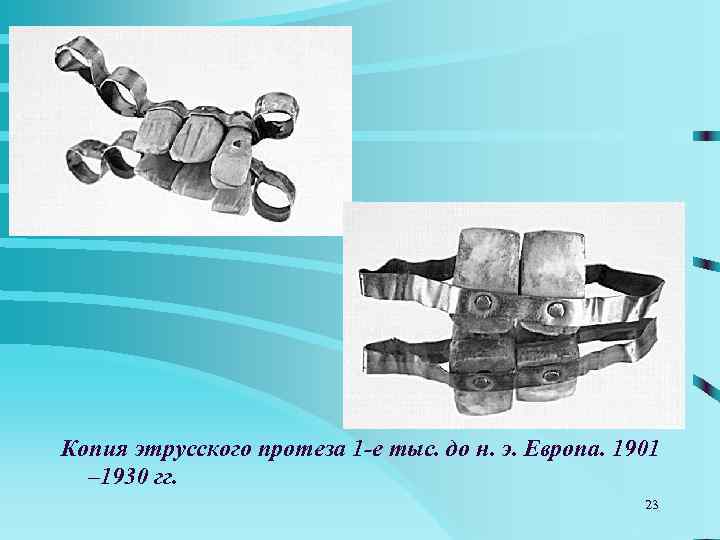 Копия этрусского протеза 1 -е тыс. до н. э. Европа. 1901  – 1930