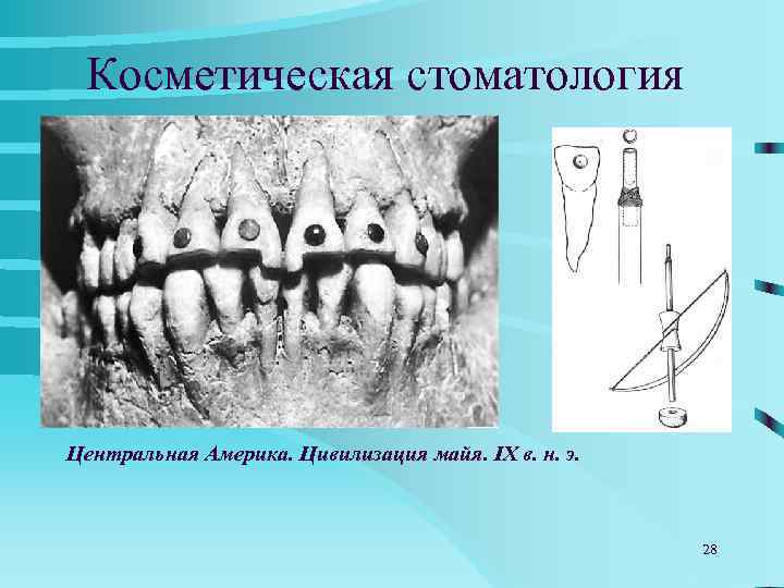  Косметическая стоматология Центральная Америка. Цивилизация майя. IX в. н. э.   