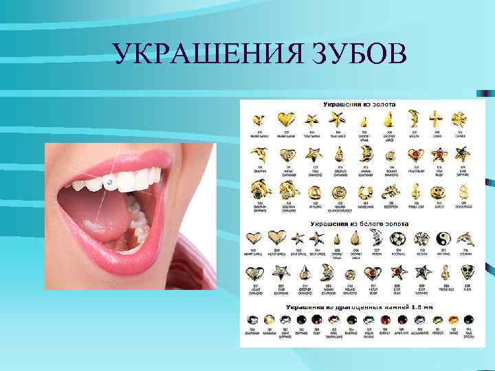 УКРАШЕНИЯ ЗУБОВ 