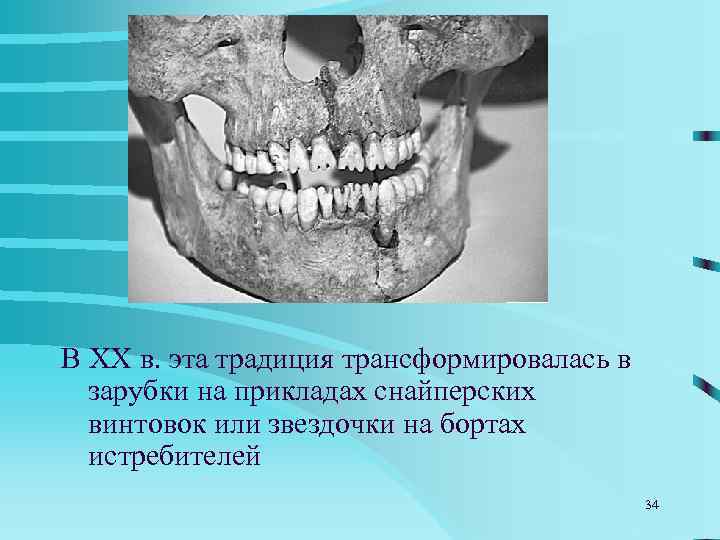 УКРАШЕНИЯ ЗУБОВ 