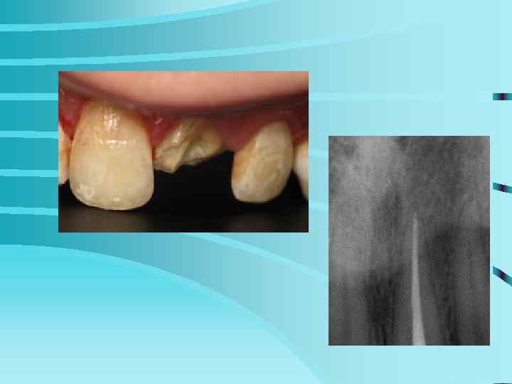 Возможности терапевтической стоматологии    (С. Радлинский) 