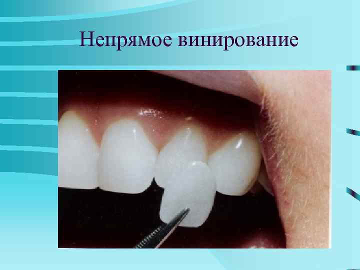 СТОМАТОЛОГИЧЕСКОЕ МАТЕРИАЛОВЕДЕНИЕ     78 