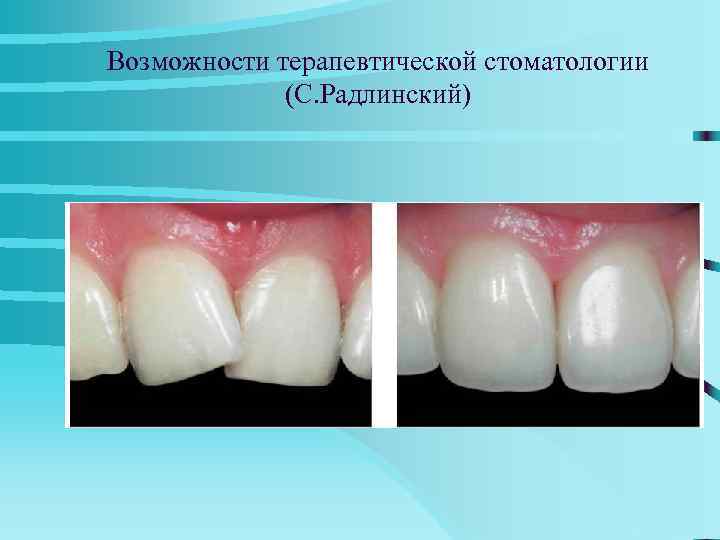  The Last Laugh - часы  с зубами  Оригинальные ходики The Last
