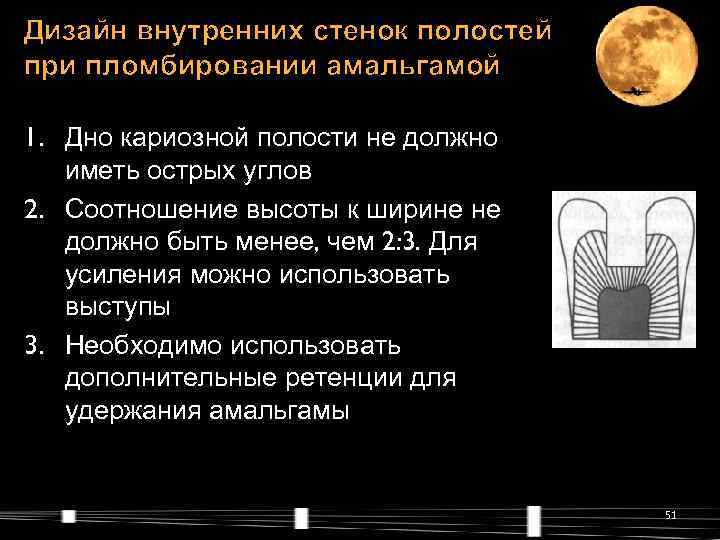 Дизайн внутренних стенок полостей при пломбировании амальгамой 1. Дно кариозной полости не должно 