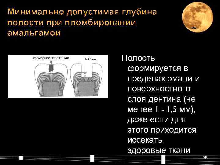 Вертикальная полость глубиной менее 20 м называется. Форма дна полости при амальгамы. Стоматологическая Амальгама материаловедение. Процесс работы с амальгамой в полости.