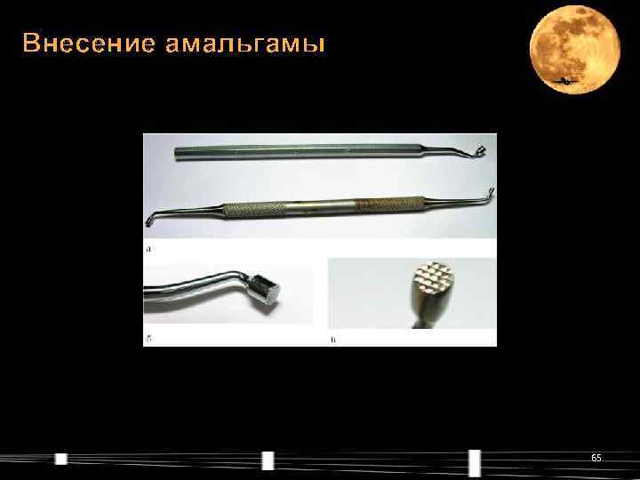 Внесение амальгамы     65 