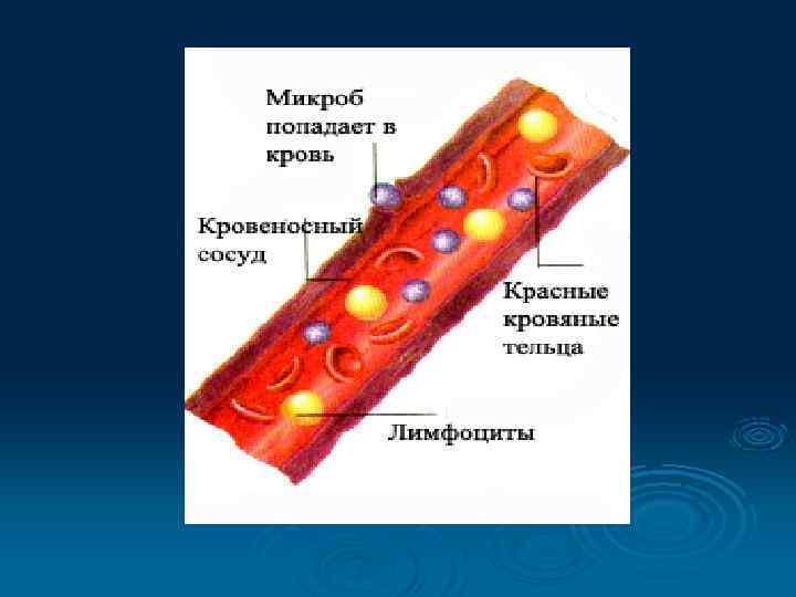   Патологические лейкоцитозы Ø  Инфекционный- при пневмонии, менингите, скарлатине и др. Ø