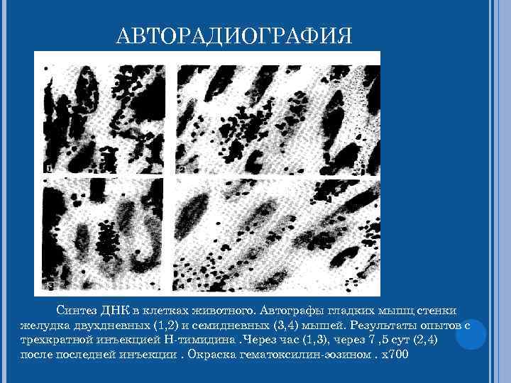  АВТОРАДИОГРАФИЯ Синтез ДНК в клетках животного. Автографы гладких мышц стенки желудка двухдневных (1,