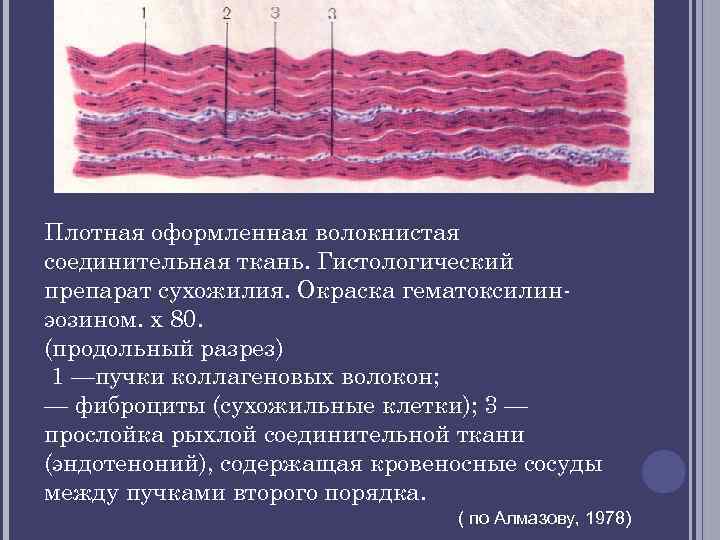 Плотная оформленная волокнистая соединительная ткань. Гистологический препарат сухожилия. Окраска гематоксилин эозином. х 80. (продольный