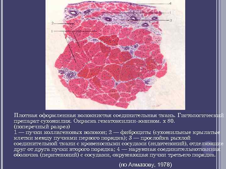 Плотная оформленная волокнистая соединительная ткань. Гистологический препарат сухожилия. Окраска гематоксилин эозином. х 80. (поперечный