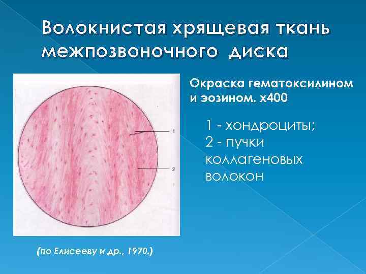 Волокнистый хрящ гистология рисунок