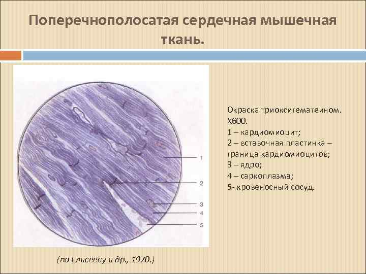 Поперечнополосатая сердечная мышечная ткань. Окраска триоксигематеином. Х 600. 1 – кардиомиоцит; 2 – вставочная